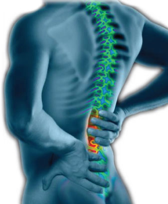 Rückenschmerzen - Was tun?